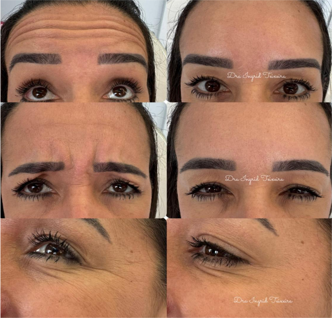 FOTOS RESULTADOS 005