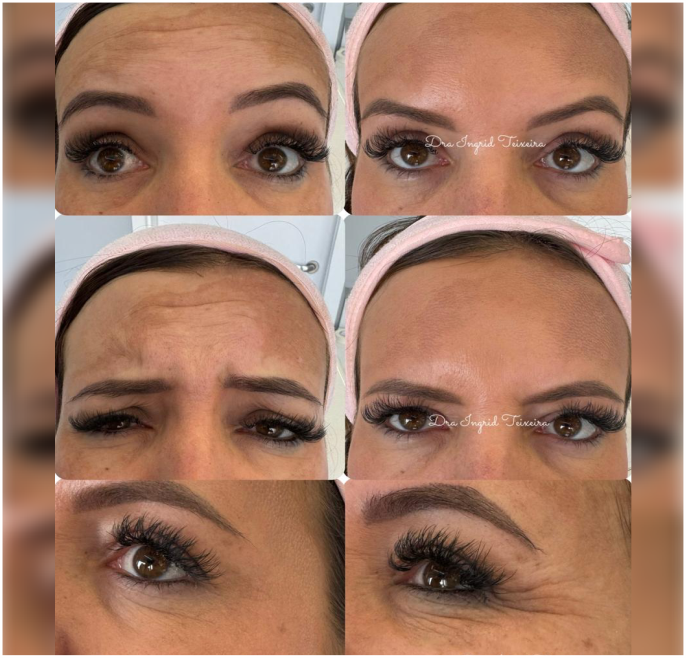 FOTOS RESULTADOS 024