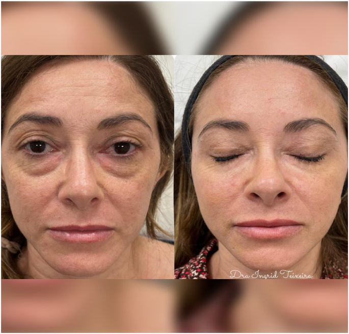 FOTOS RESULTADOS 034